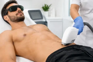 Epilazione laser dell'addome uomo: quando conviene