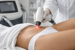 Follicolite: trattamento laser e risultati