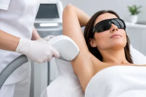 Il laser Alessandrite elimina i peli bianchi?