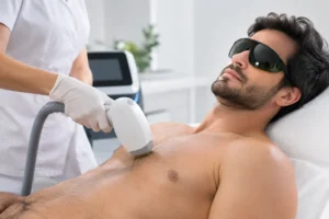 Trend depilazione maschile e scelta del laser